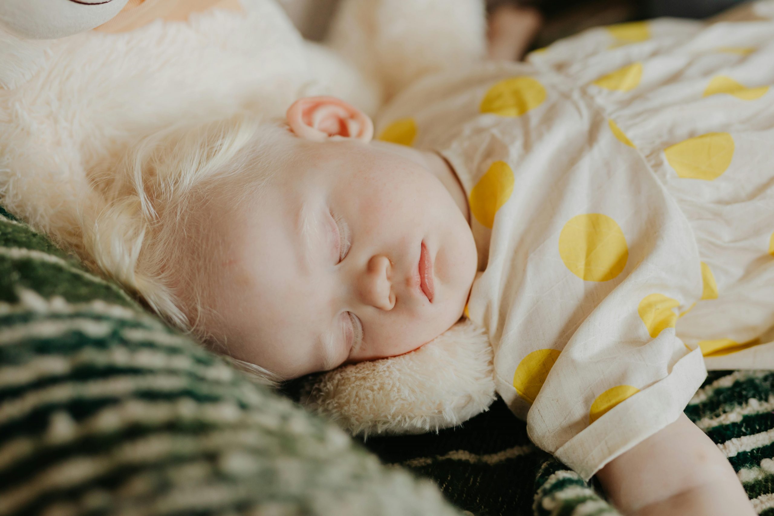 toddler wearing a polka-dotted dress, sleeping soundly